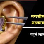 तरुणीच्या कानात अडकला साप व्हिडिओ बघून बसेल आश्चर्य